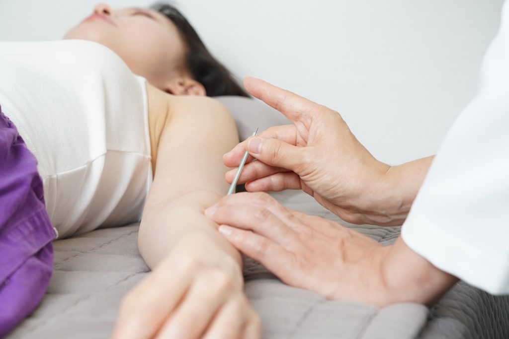 Medical Acupuncture for Pain Relief in Sutton Coldfield: What It Is and How It Works Acupuncture at sutton coldfield